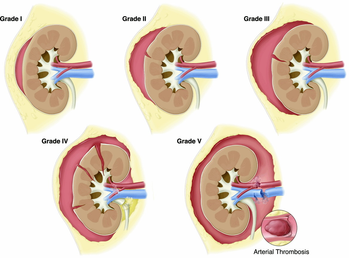 Cuidados Piercing | PDF, image size:1167x863