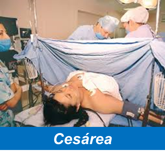 Cesarea