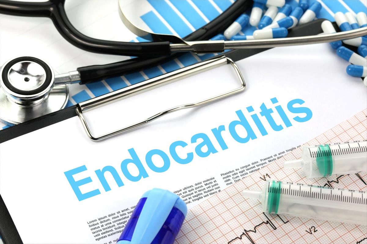 Diagnóstico de endocarditis - Criterios de Duke modificados