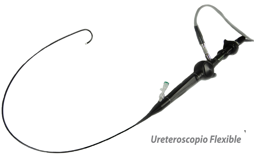 Ureteroscopio flexible