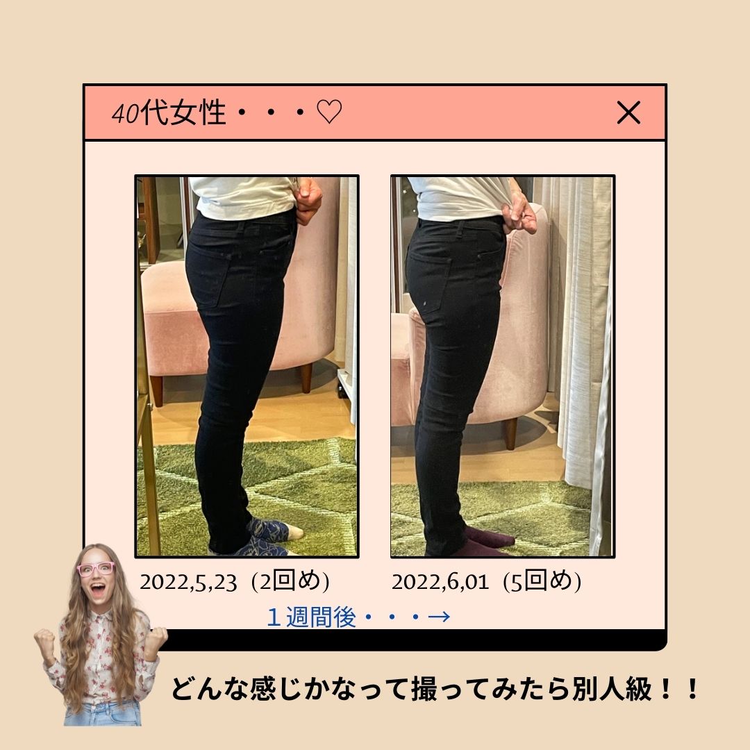 最新HIFEM技術 痩身マシン - pilialohaamk ページ! 最新HIFEM技術 痩身マシン - pilialohaamk ページ!