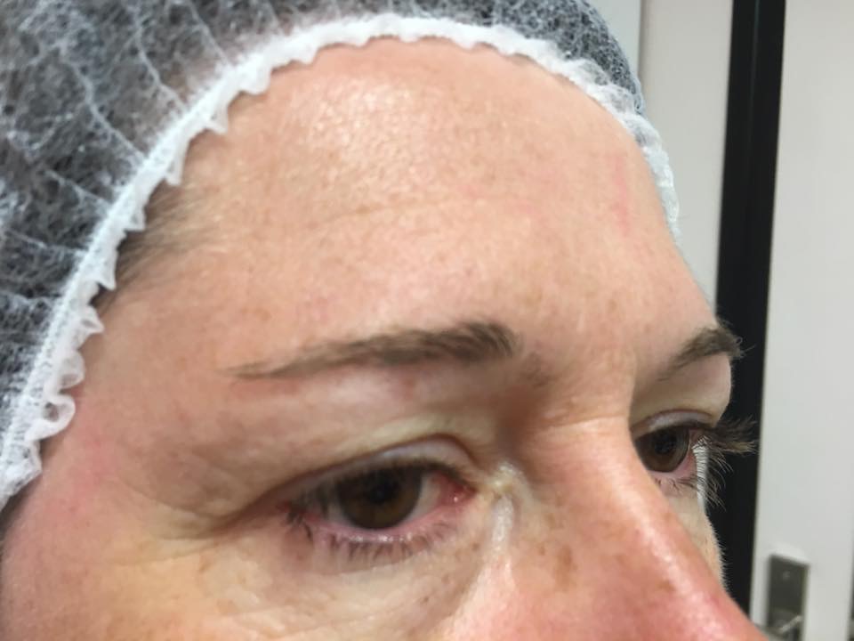Microblading Avant