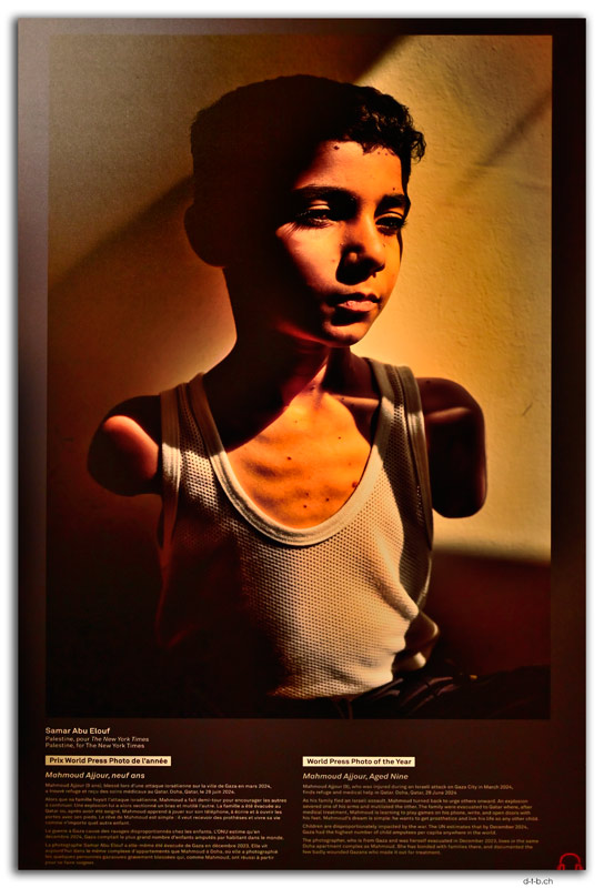 Montréal.World Press Photo Exhibition 2025.Winner