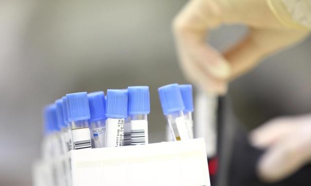 antigene prostatico specifico fpsa