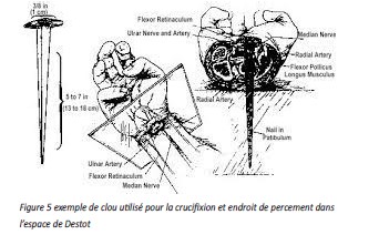 Abbildung 5 Beispiel für einen Nagel, der für die Kreuzigung verwendet wurde, und eine Piercingstelle im Destot-Raum
