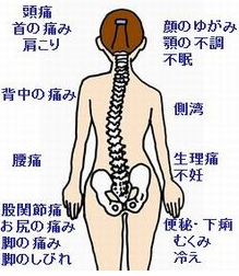 骨盤がゆがむと背骨が湾曲してしまいます。また、様々の症状の原因となります。