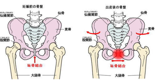 出産時は仙腸関節と恥骨結合に大きな負担がかかりますので、産後の腰痛や恥骨結合の痛みの原因になります。仙腸関節を正常に戻す事が必要です。