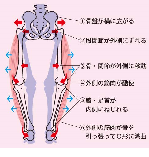 このように、骨盤や股関節に異常がおこると、膝に大きな負担がかかり痛みの原因となってしまいます。