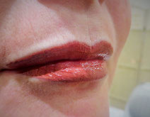 Lip Blush that heals with the desired affect 