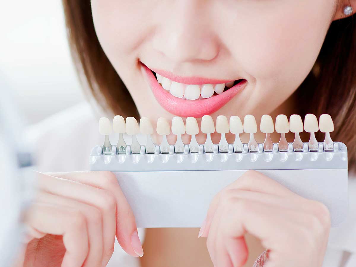 臨床歴20年の私が歯科ホワイトニングを勧める５つの理由