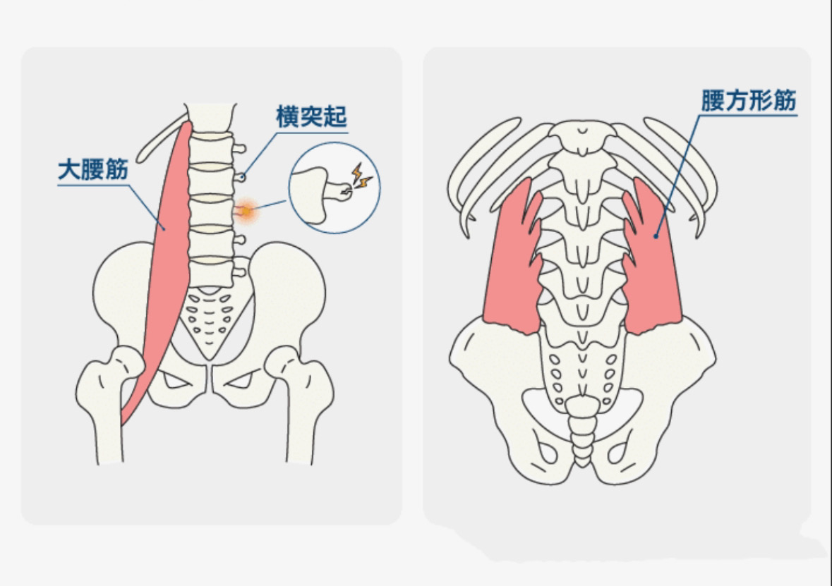 腰椎横突起骨折(￣▽￣;)