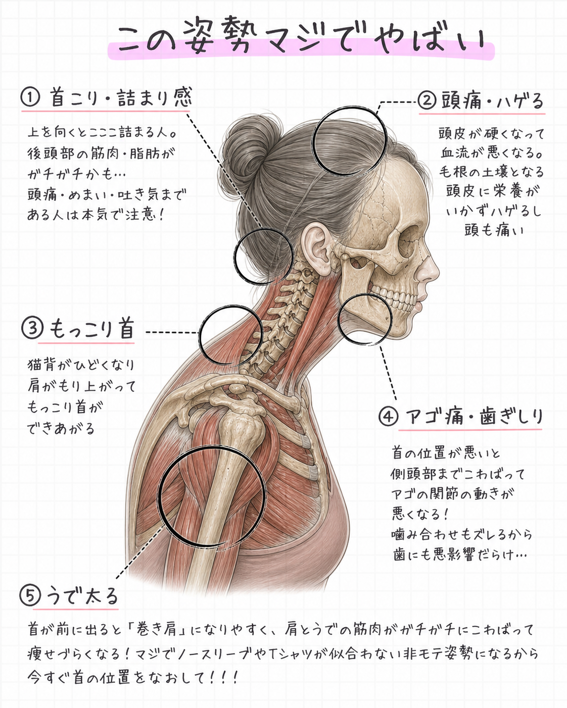 ストレートネックの身体への影響