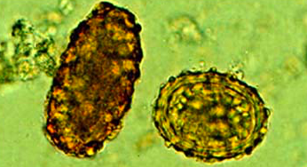 Oeuf d'Ascaris spp. non embryonné (gauche) et embryonné (droite) (https://www.wikidoc.org/index.php/Ascariasis_laboratory_tests)