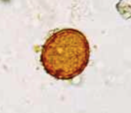 Spore de rouille d'oseille (Uredo bifrons) (Petithory et al., 1995)