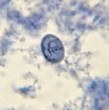 Kyste de Retortamonas intestinalis coloré à l'hématoxyline ferrique (http://www.atlas-protozoa.com/gallery.php?SOT_CAP=F_RETRO&link=index.php#4)