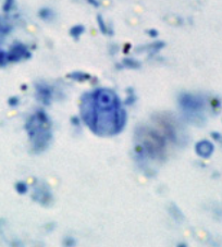 Kyste de Retortamonas intestinalis coloré au trichrome (http://www.atlas-protozoa.com/gallery.php?SOT_CAP=F_RETRO&link=index.php#4) 