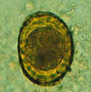 Oeuf d'Ascaris spp. embryonné (https://www.wikidoc.org/index.php/Ascariasis_laboratory_tests)
