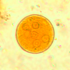 Kyste d'Entamoeba coli coloré au Lugol (https://www.cdc.gov/dpdx/intestinalamebae/index.html)