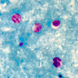 Oocystes de Cryptosporidium spp. colorés par la coloration de Ziehl-Neelsen modifiée (https://www.cdc.gov/dpdx/cryptosporidiosis/index.html)