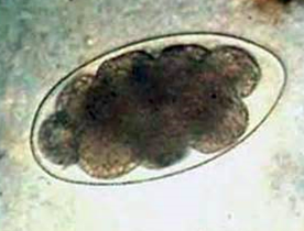 Oeuf de Trichostrongyloidea (https://instruction.cvhs.okstate.edu/jcfox/htdocs/clinpara/Trichost.htm)