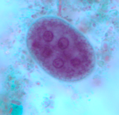 Kyste d'Entamoeba coli coloré au trichrome (https://www.cdc.gov/dpdx/intestinalamebae/index.html)