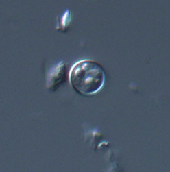 Oocyste de Cyclospora spp. visualisé au microscopie à contraste interférentiel (https://www.cdc.gov/dpdx/cyclosporiasis/index.html)