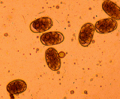 Oeufs d'Ancylostoma spp. et Necator spp. (http://missinglink.ucsf.edu/lm/virus_and_parasites/hookworm.html)