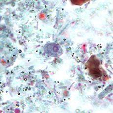 Kyste de Retortamonas intestinalis coloré au trichrome (https://www.cdc.gov/dpdx/retortamonas/index.html)