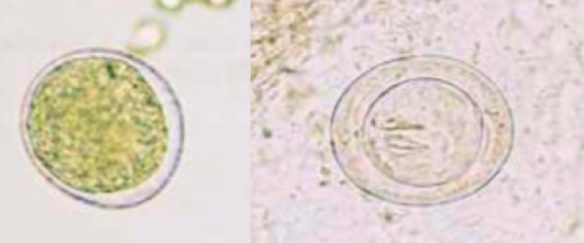 Pollen d'orge (Hordeum vulgare) (gauche) et oeuf d'Hymenolepis nana (droite) (Petithory et al., 1995)
