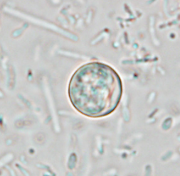 Oocyste de Cyclospora spp. visualisé sans coloration (https://www.cdc.gov/dpdx/cyclosporiasis/index.html)