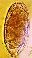 Oeuf d'Oesophagostomum spp. (https://parasitipedia.net/index.php?option=com_content&view=article&id=2629&Itemid=2906)