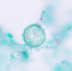 Oocyste de Cyclospora spp. visualisé après coloration au trichrome (https://www.cdc.gov/dpdx/cyclosporiasis/index.html)
