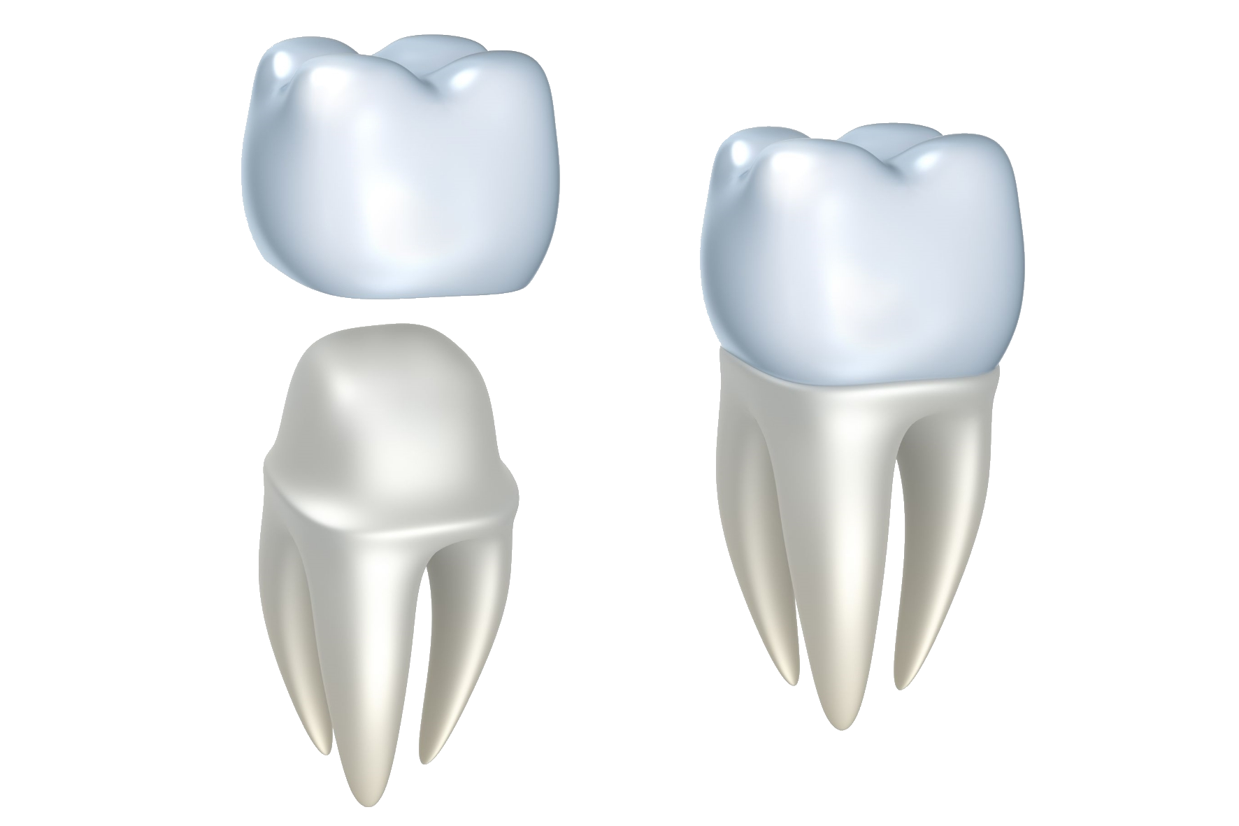 Zahnkronen – haltbarer als die Natur - Zahnarzt