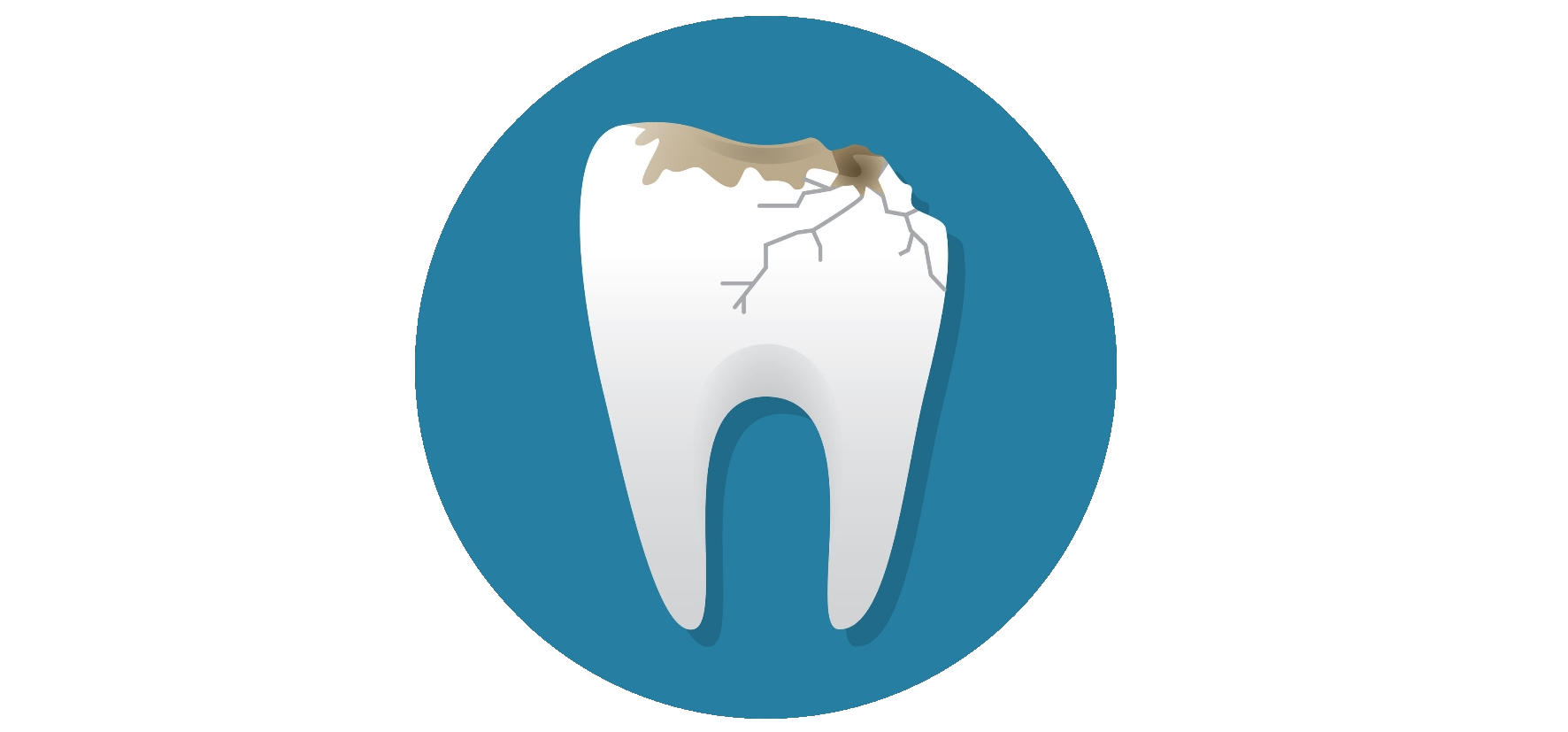 Zahn Abgebrochen Schnelle Hilfe Im Notfall Zahnarzt