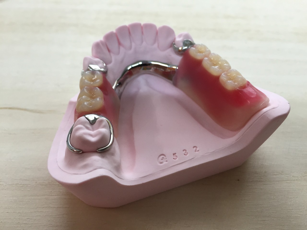 複合 義歯 と は