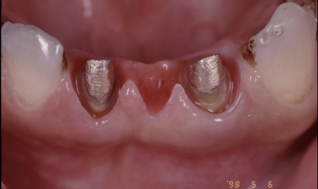 Before