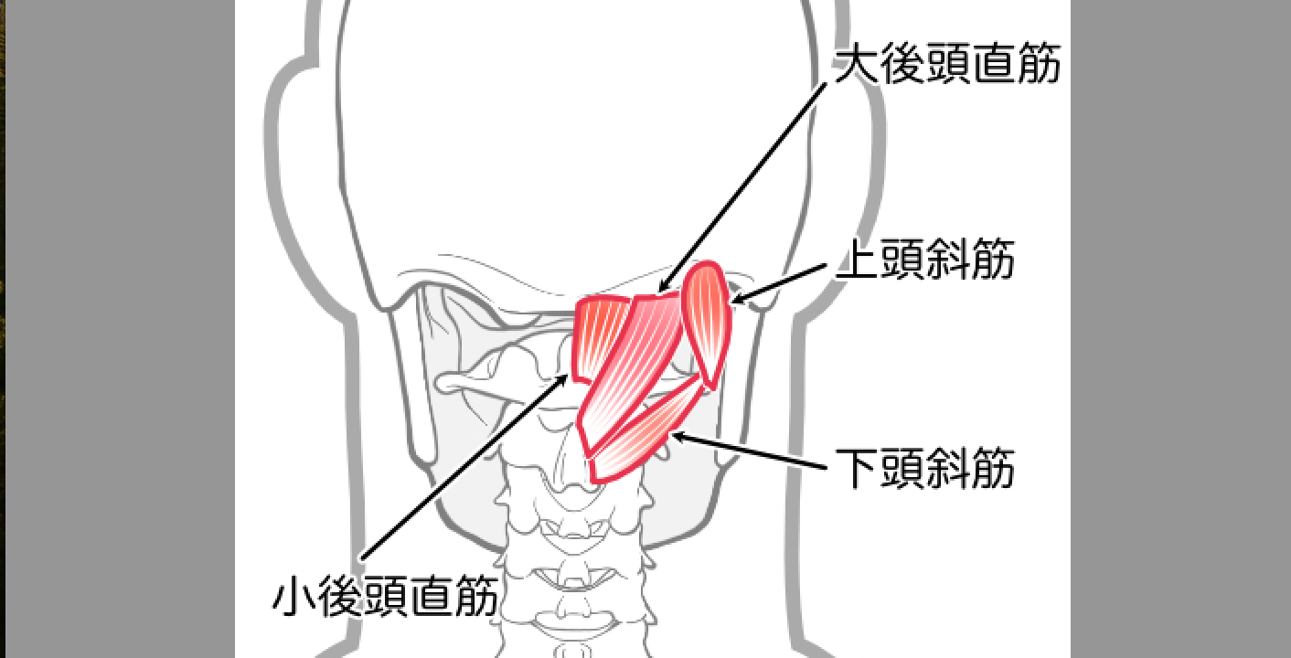 症例報告