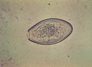 Pinworm egg