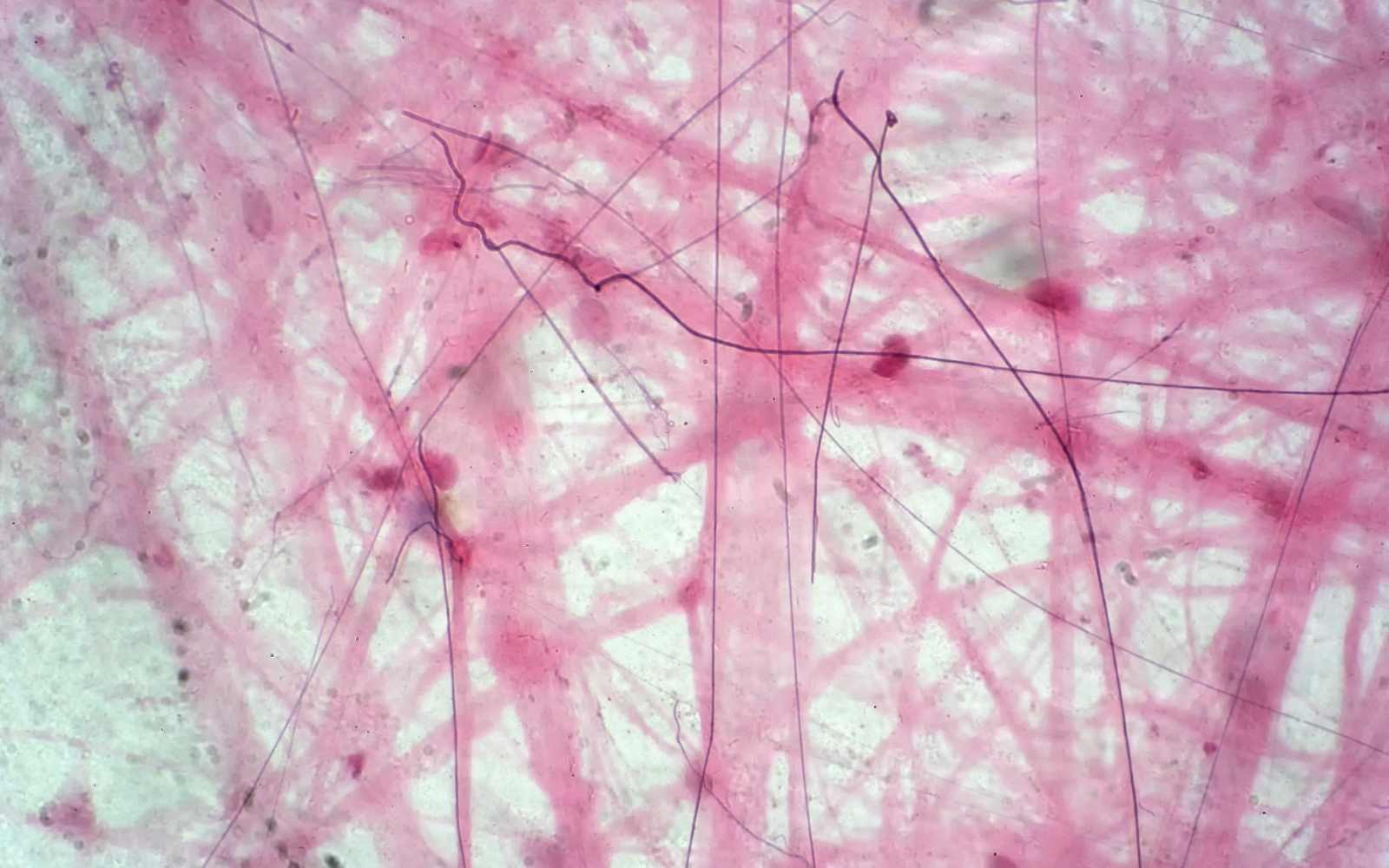 Faszination Faszien, gut strukturiert und geschmeidig sollten Faszien sein, Eiskristalle