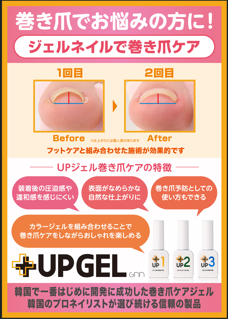 巻き爪ケア　【UPジェル】導入しました