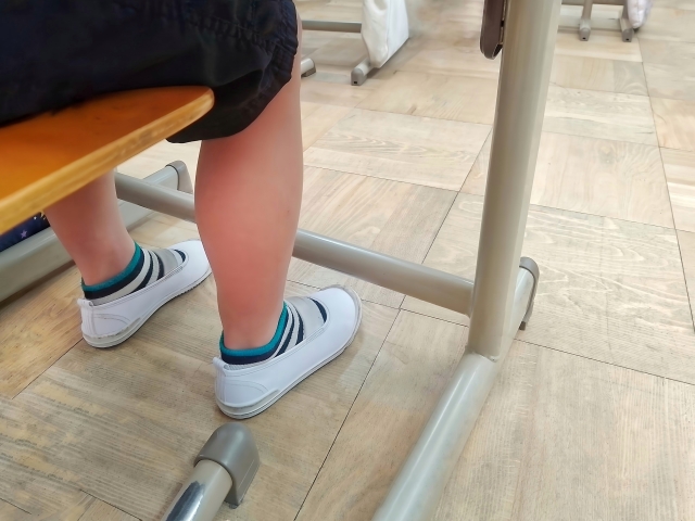 子どものウオノメはまず皮膚科受診を！