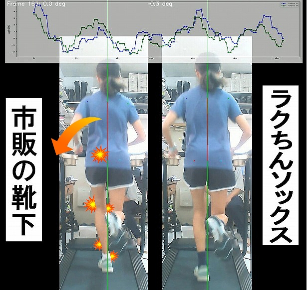 フォームが崩れると怪我をする理由
