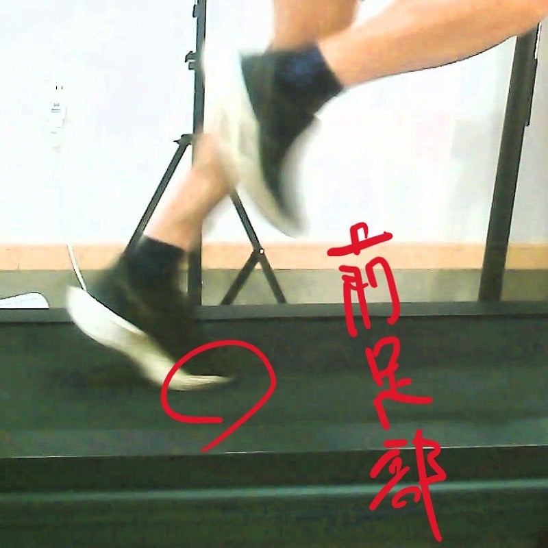 フォアフット