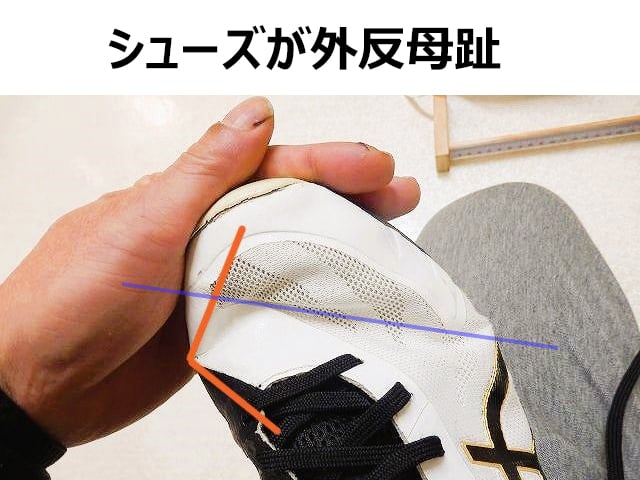 外反母趾にオススメのランニングシューズのセッティング