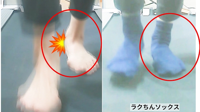 外反母趾が気になるあなたへ│オススメの靴下