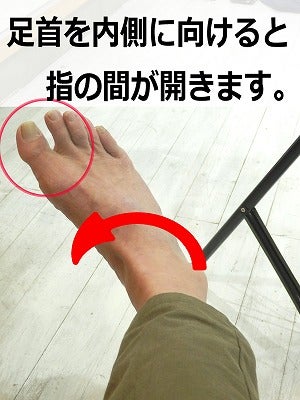 外反母趾(がいはんぼし)の治し方