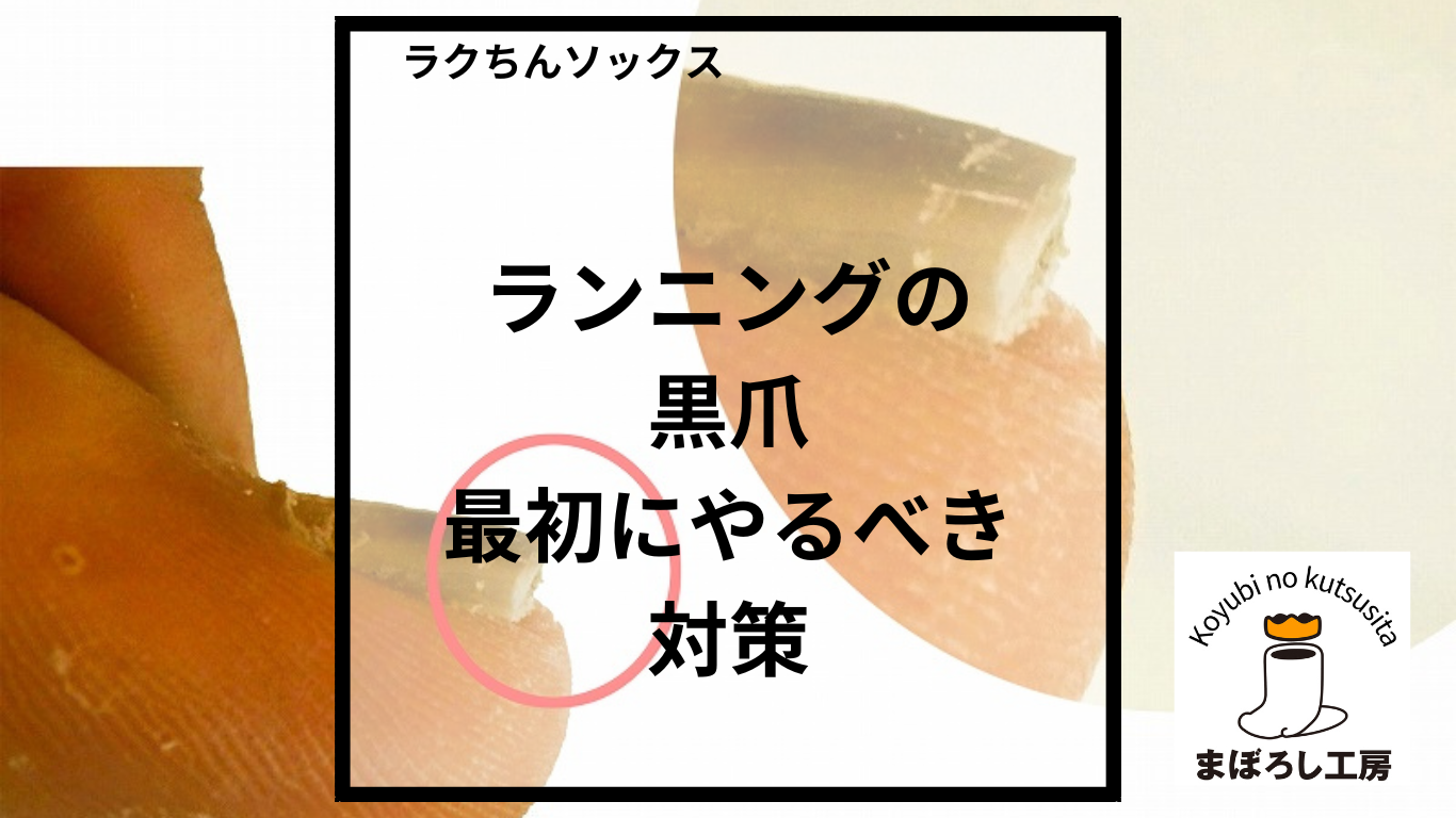 目からウロコ│ランニングの黒爪│もっとも簡単で最初にやるべき対策