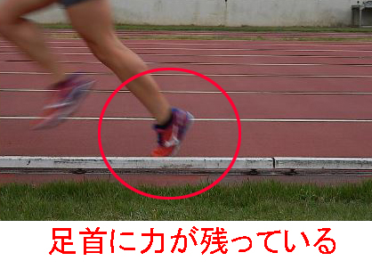 中足骨骨折はココに注意│ディスエンゲージメント