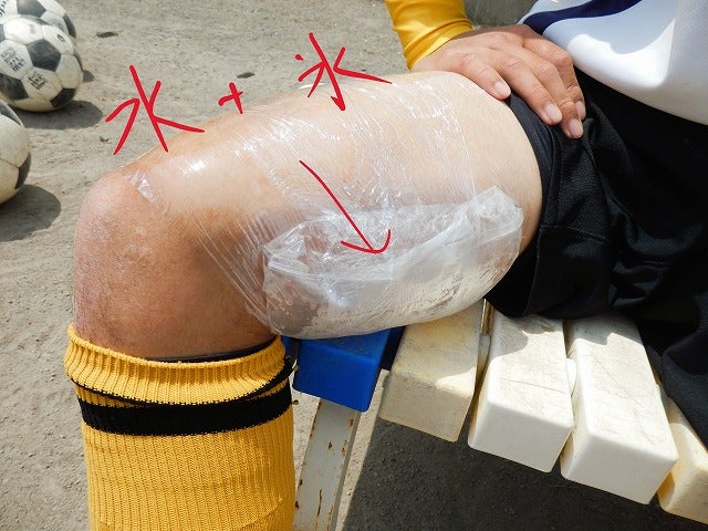アイシング完全ガイド｜どれくらい・何で・いつまで？