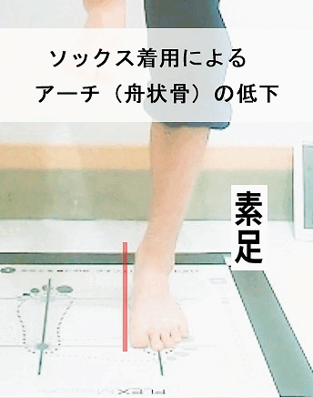 プロネーションの治し方